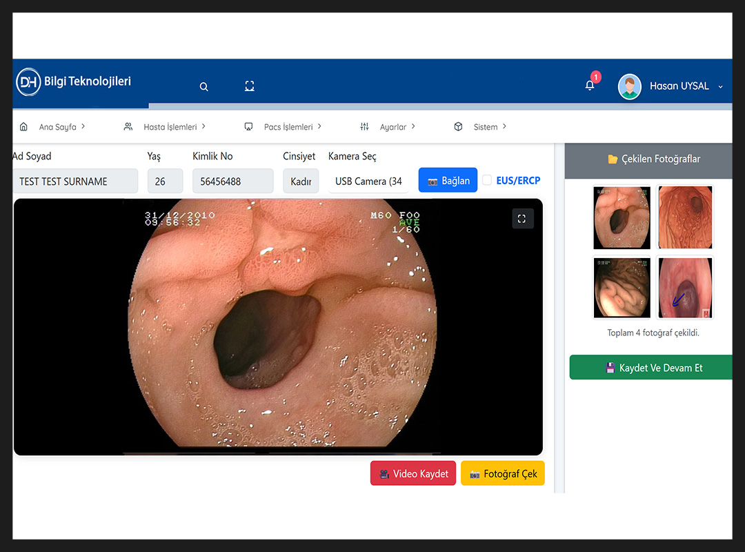 Deha Endoskopi Yazılımı